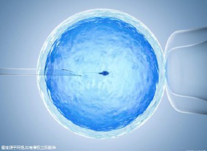 男性因素